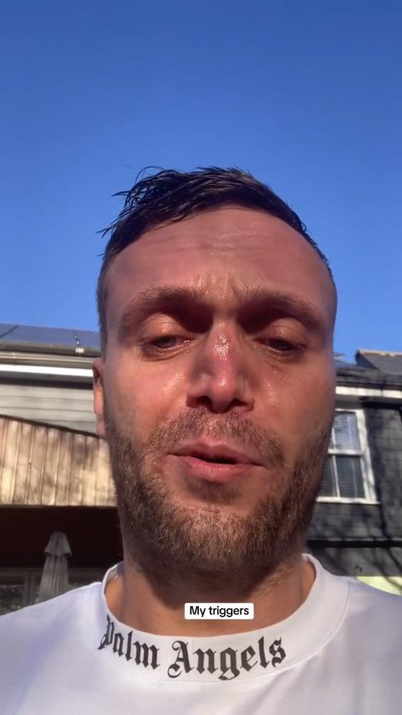 Šejn Samler je upropastio nos od prekomerne konzumacije kokaina