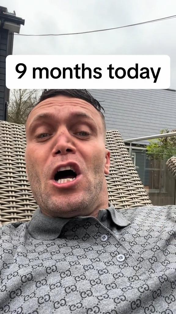 Šejn Samler je upropastio nos od prekomerne konzumacije kokaina