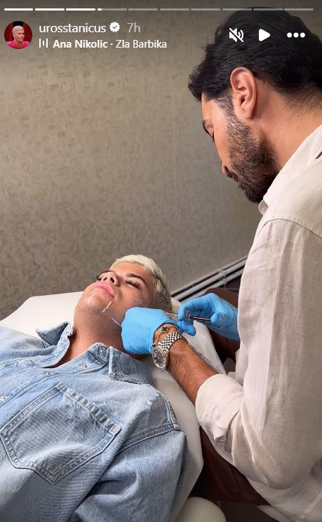 Uroš Stanić snimio proces estetskog zahvata na licu
