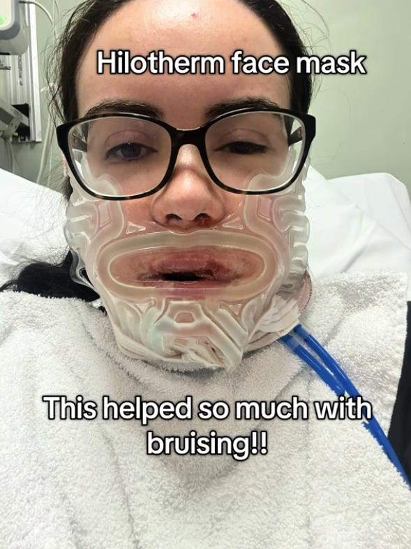 Luiza Mekdermot operacija vilice (5).png