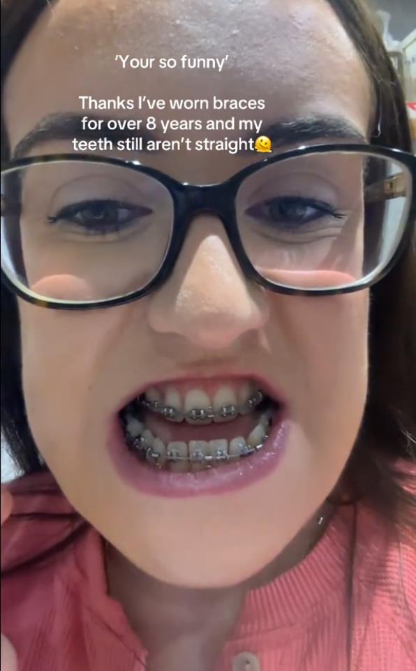 Luiza Mekdermot operacija vilice (3).png