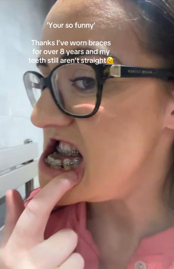 Luiza Mekdermot operacija vilice (4).png