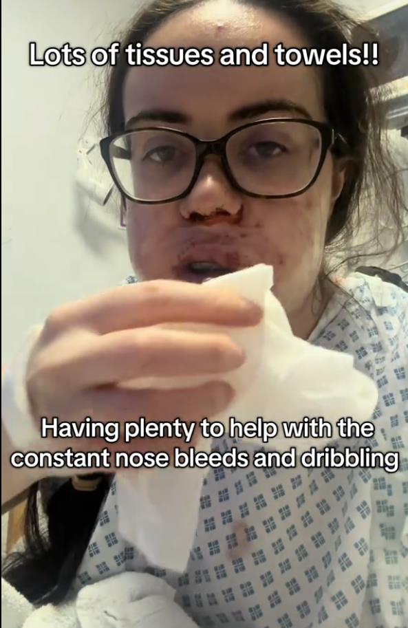 Luiza Mekdermot operacija vilice (6).png