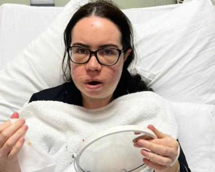 Luiza Mekdermot operacija vilice (8).png