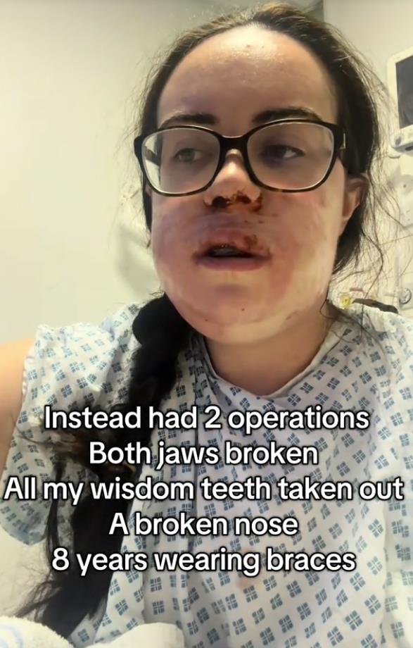 Luiza Mekdermot operacija vilice (9).png