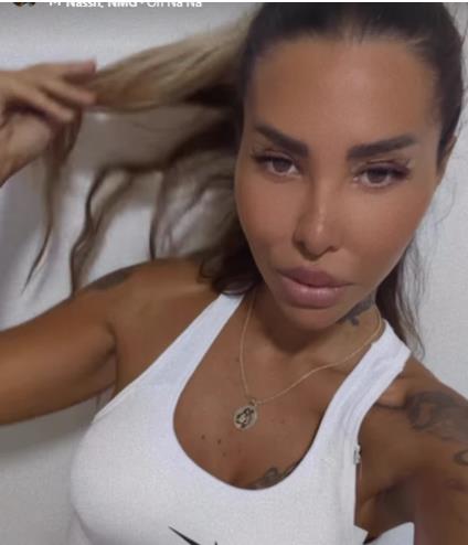 Aneli Ahmić pokazala lice nakon estetskih korekcija