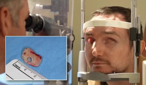 Brent Čepmen i oko od zuba.jpg