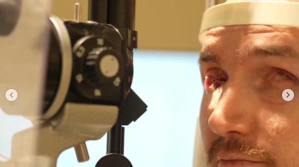 Brent Čepmen usred tretmana za oko.jpg