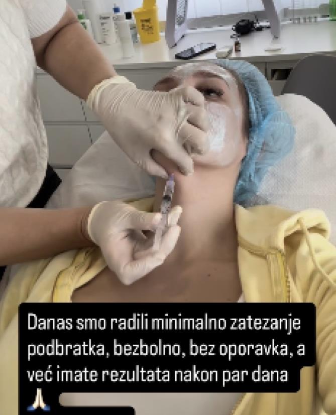 Luna Đogani na estetskoj korekciji