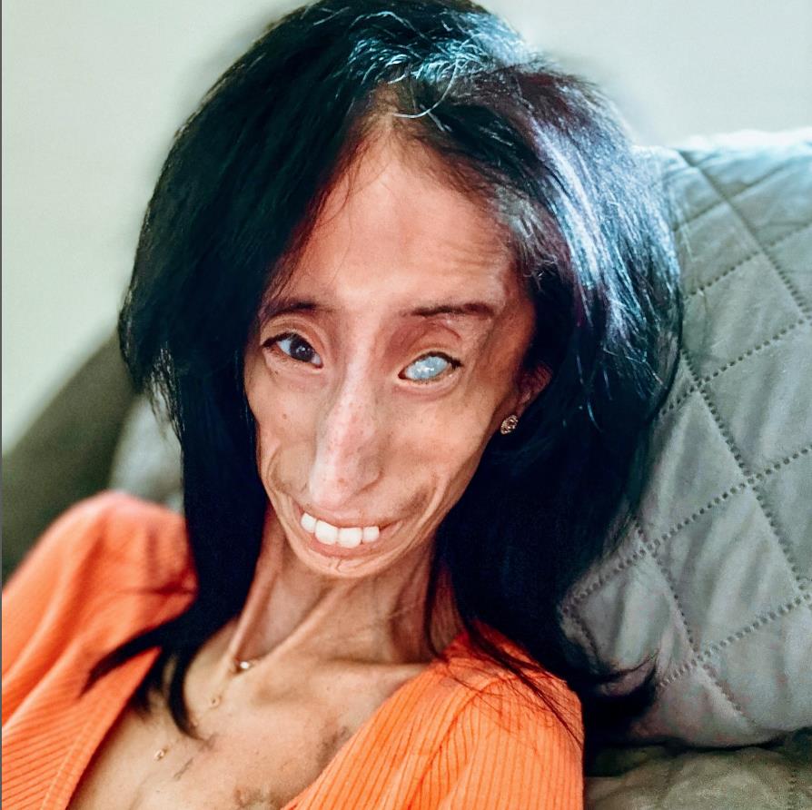 Lizi Valaskez u narandžastoj majici.jpg