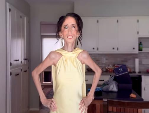 Lizi Valaskez u žutoj haljini.jpg