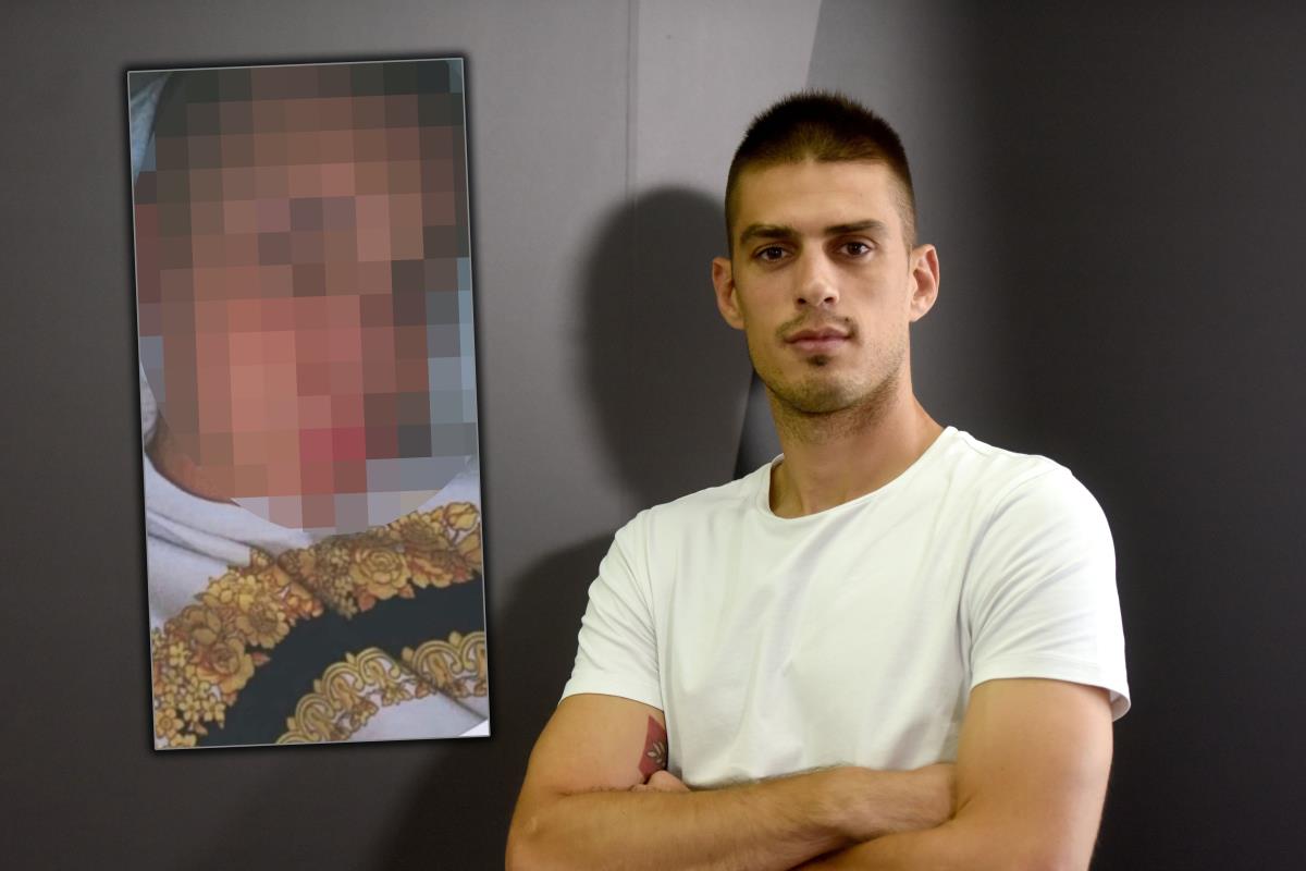 Kako je A.K. izgledala pre plastičnih operacija