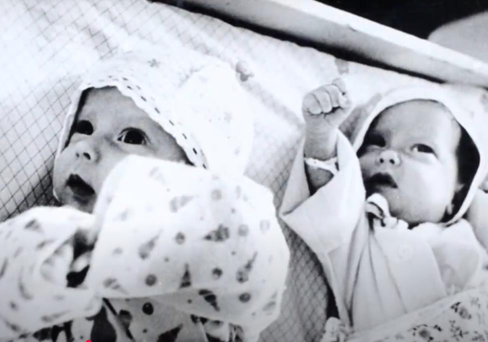 Sijamske bliznakinje Ana i Tanja Korkinova - bebe.jpg