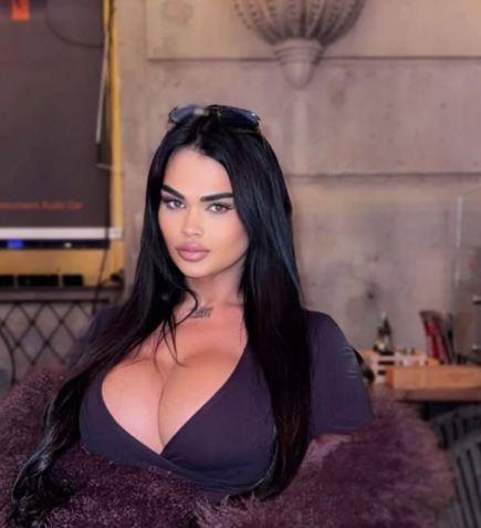 "MORAĆU DA ŽIVIM S TIM" Transrodna Kiki smršala 80 KG i tvrdi da su joj lekari LOŠE uradili silikone - objavila i pokazala provokativni dekolte