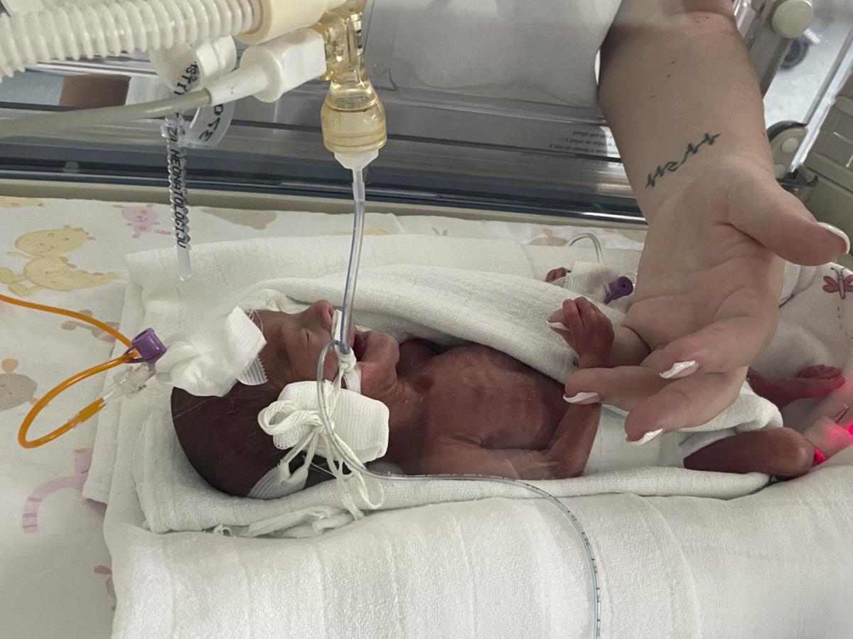 Kruna prevremeno rođena beba u inkubatoru