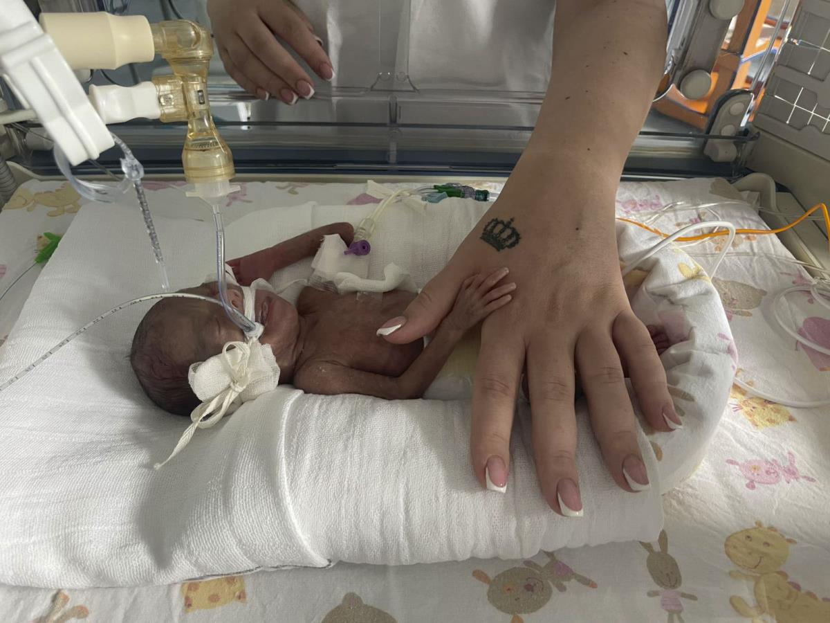 Kruna prevremeno rođena beba u inkubatoru