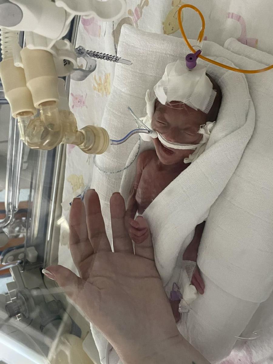 Kruna prevremeno rođena beba u inkubatoru