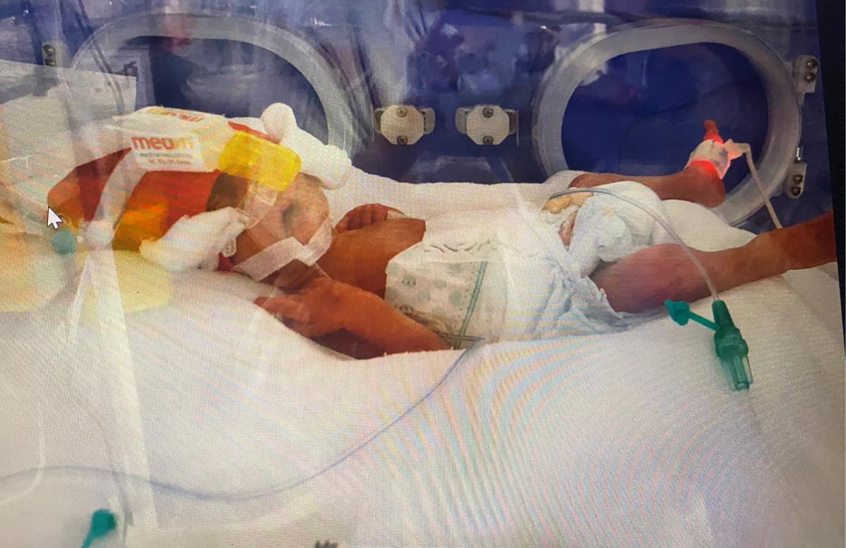 Viktor prevremeno rođena beba u inkubatoru
