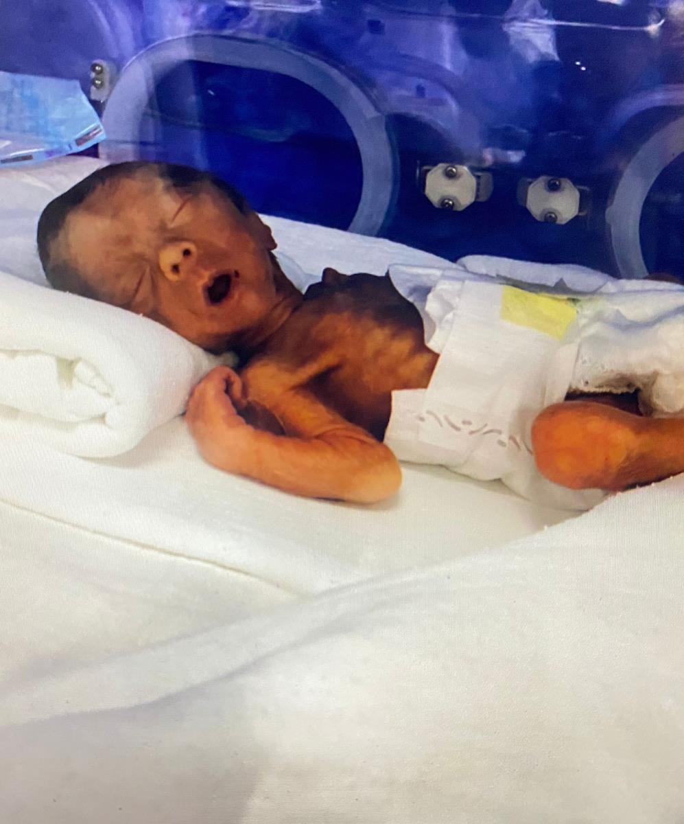 Viktor prevremeno rođena beba u inkubatoru