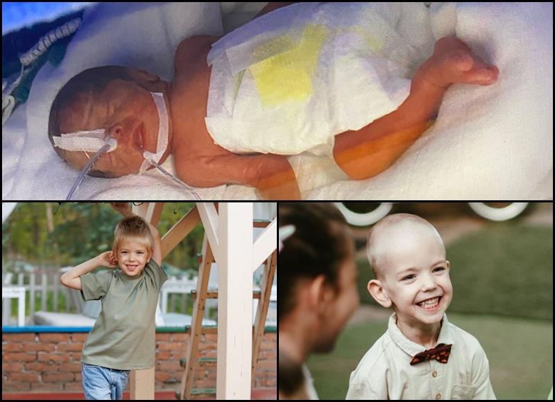 Viktor prevremeno rođena beba kolaž