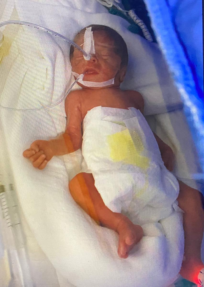 Viktor prevremeno rođena beba u inkubatoru