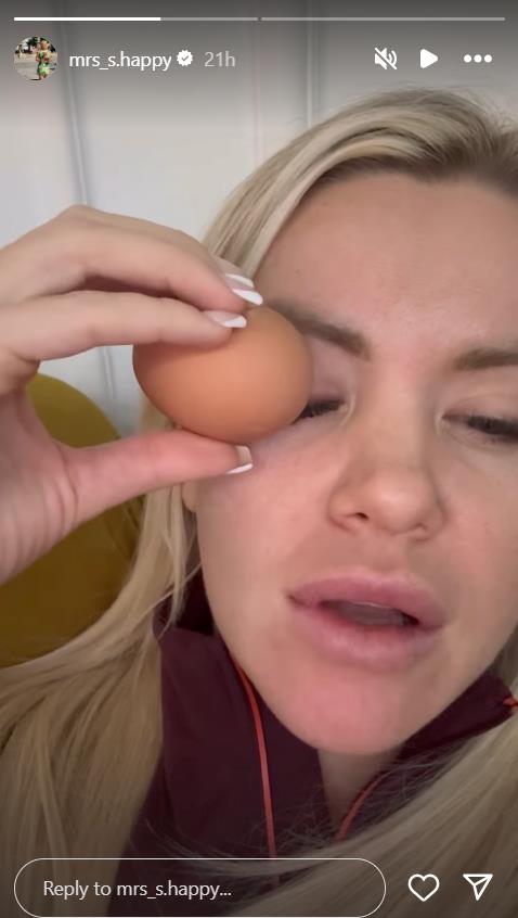 POZNATA VODITELJKA NEPREPOZNATLJIVA Lice izobličeno, oko naduto, crveno: Mnogo me boli... (FOTO)