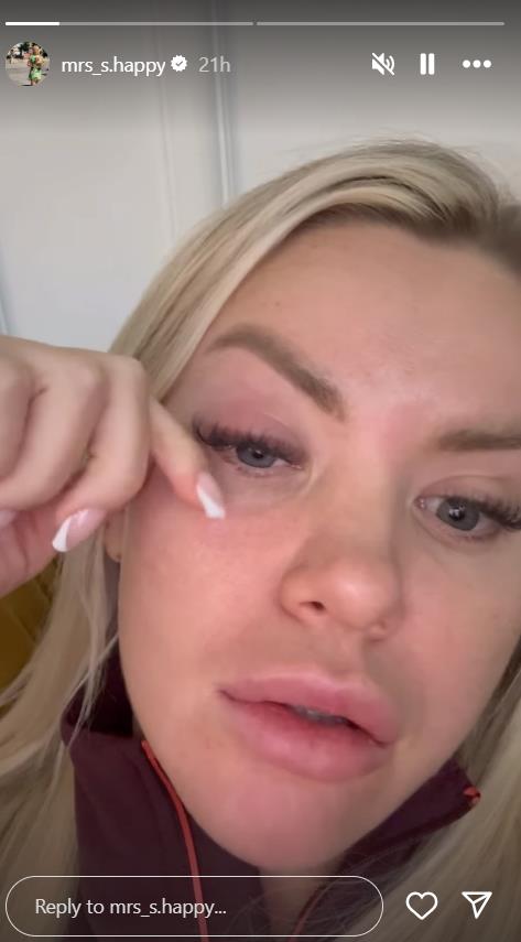 Sanja Stanković objavila snimak na kom joj je oko natečeno