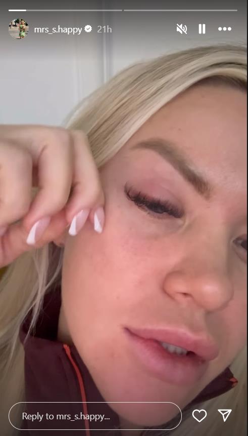 Sanja Stanković objavila snimak na kom joj je oko natečeno