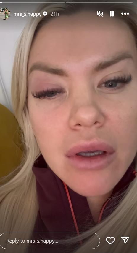 Sanja Stanković objavila snimak na kom joj je oko natečeno