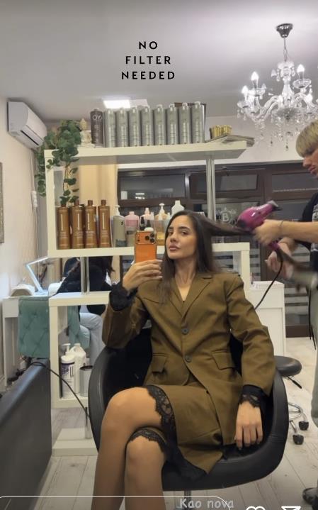 Anđela Đuričić nakon operacije nosa