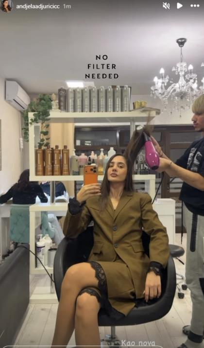 Anđela Đuričić nakon operacije nosa