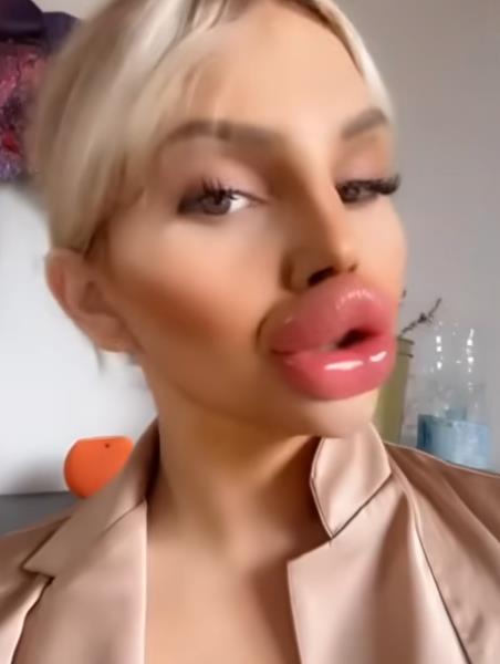 Vijena Vurstel ima najveće usne na svetu