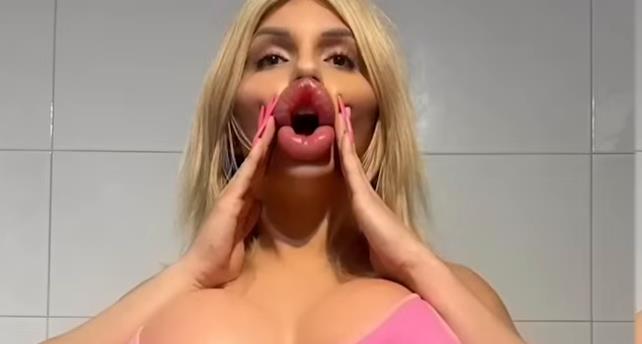 Vijena Vurstel ima najveće usne na svetu