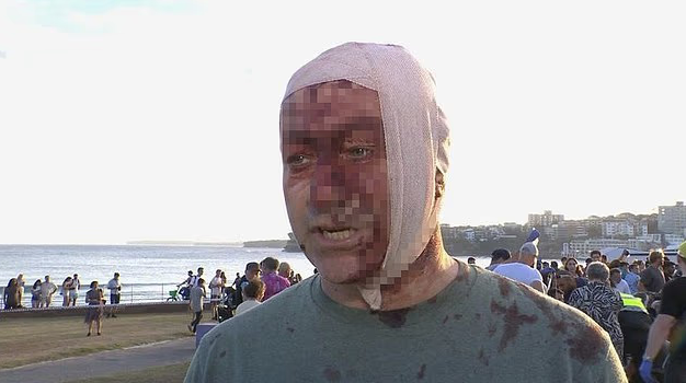 Australija Sidnej Bondi Beach Plaža žrtva (10).png