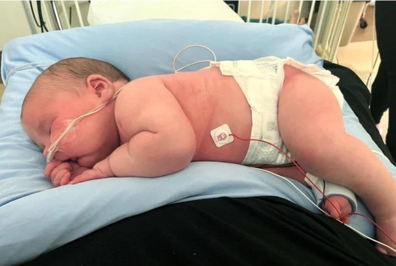 Dečak Grejson po rođenju težio 7kg.jpg