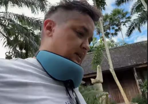 Mariju Šerifović ujeo majmun na Baliju