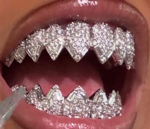 Nort Vest ugradila dijamanstke zube