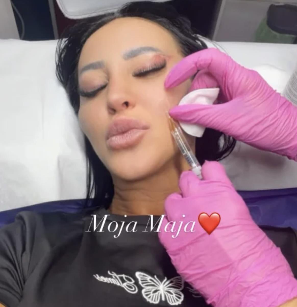 SLAĐA PORŠELINA DAJE SVE OD SEBE DA BUDE LEPA! Otišla po ko zna koji put pod iglu, evo šta je starleta sada menjala na sebi