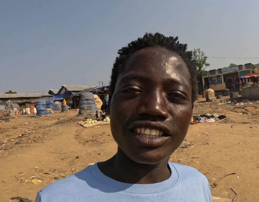 Abuše iz Etiopije sa retkim plavim očima, dečak iz Džinke (1).jpg