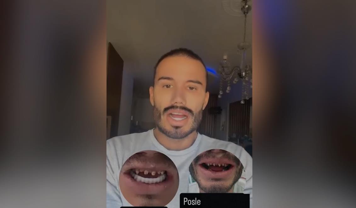 OGLASIO SE FRIZER KOJEG POVEZUJU SA KRAHOM PRIJATELJSTVA MAJE I MATIJE! Progovorio o Raduloviću i otkrio šta se zaista tu desilo