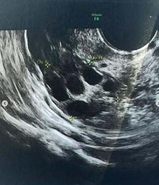 Aleksandra Tadić Cipka imala ozbiljnih zdravstvenih problema