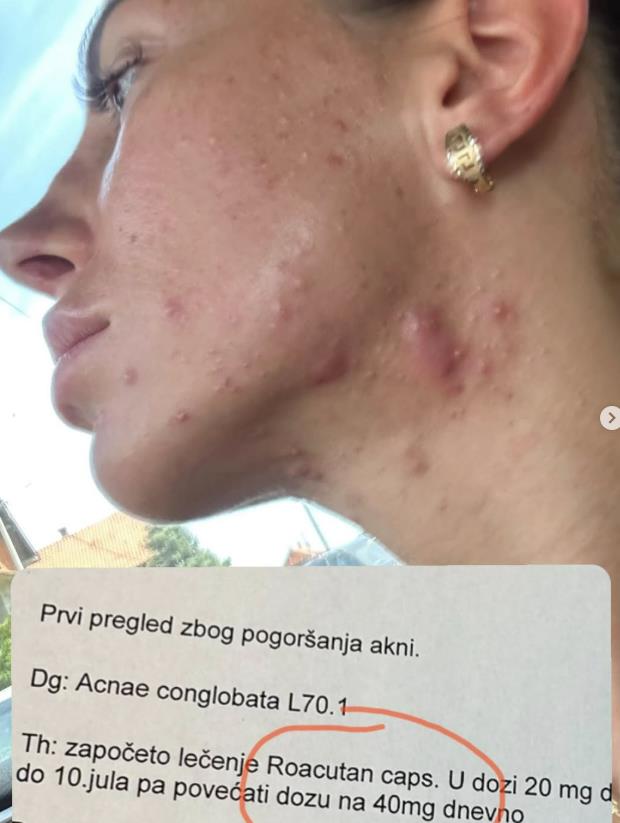 Aleksandra Tadić Cipka imala ozbiljnih zdravstvenih problema