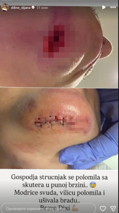 Dijana Dilajn se oglasila iz bolnice