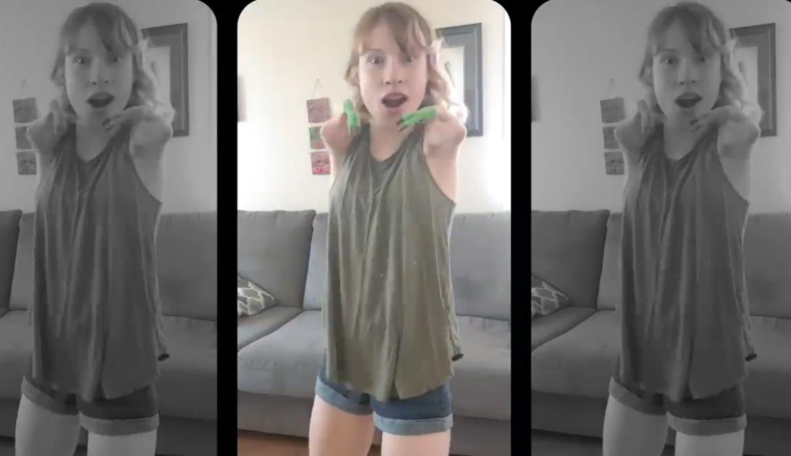 Debora Del - rođena sa tetrafokomelijom