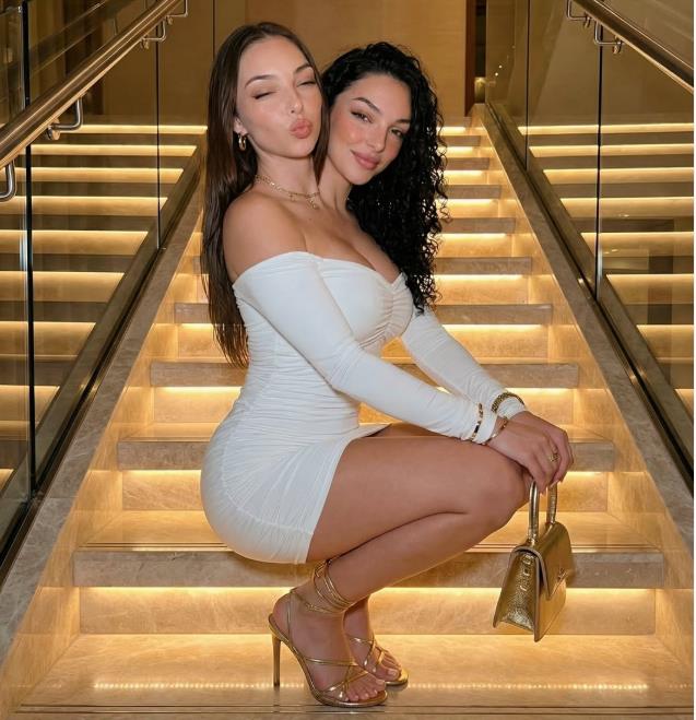 Sijamske bliznakinje Valerija i Kamila iz Majamija