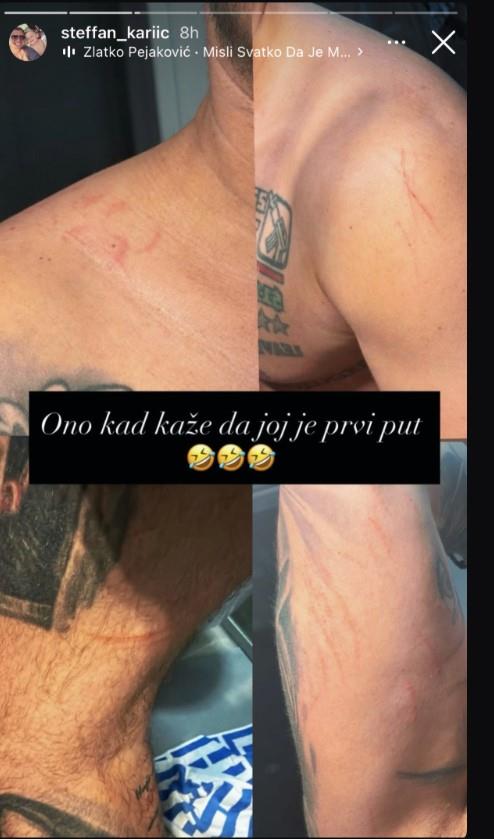 IZUJEDAN I IZGREBAN! Stefan Karić objavio sliku nakon intimnog odnosa i pokazao rane: Kad kaže da joj je prvi put (FOTO)