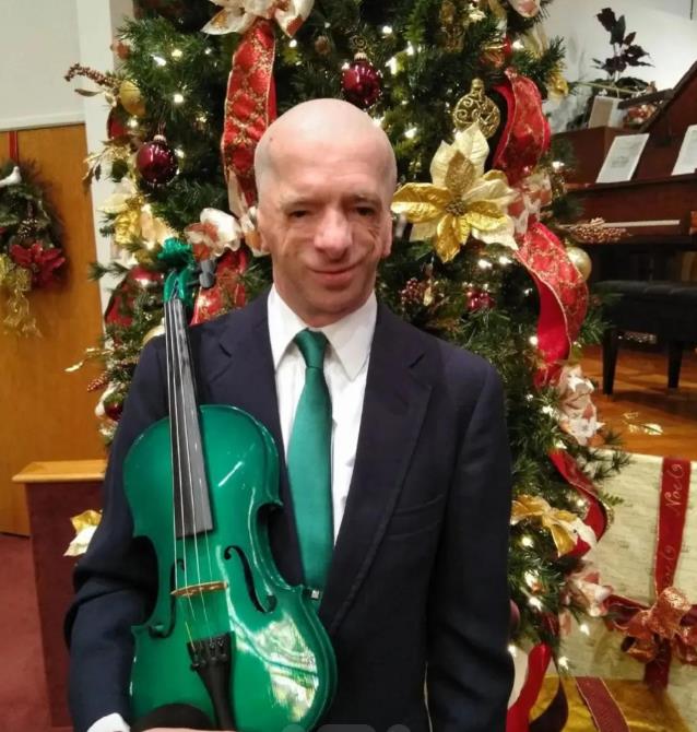 Frensis Džoel Smit - rođen sa Tričer Kolins sindromom