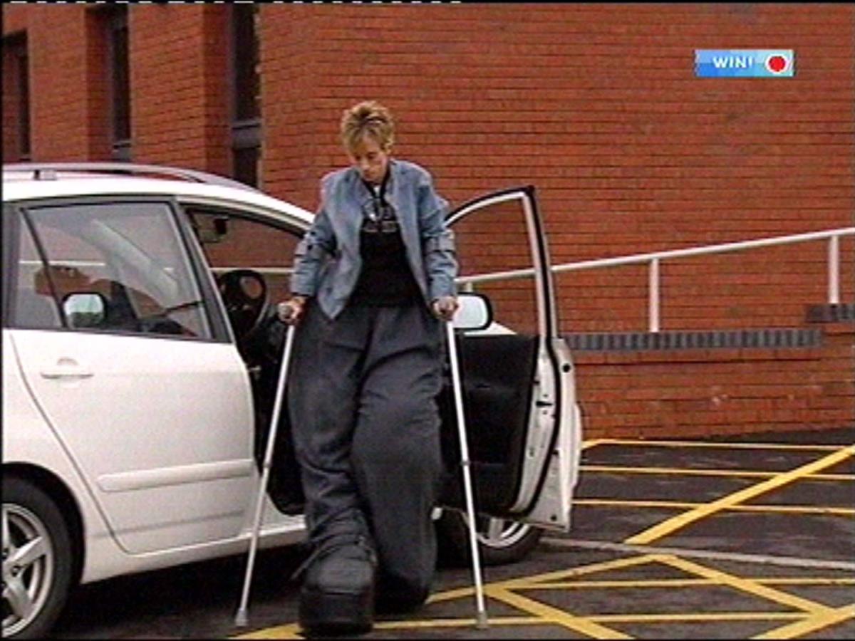 Mendi Selars - žena kojoj noge nisu prestale da rastu