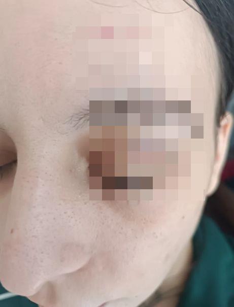 Golman prebio suprugu