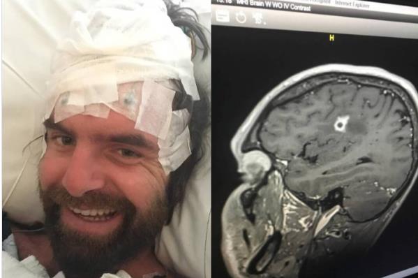 Tajson Botenus - pao sa bicikla pa dobio gljivicu u mozgu